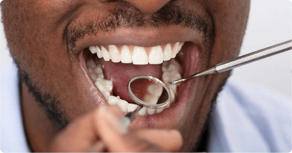 Dentist examining a patient's teeth with a mirror